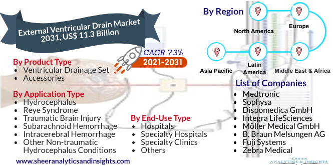 External Ventricular Drain Market